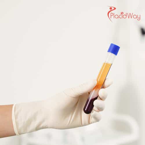 PRP & Stem Cell Therapy in Malaysia: Advanced Regenerative Medicine